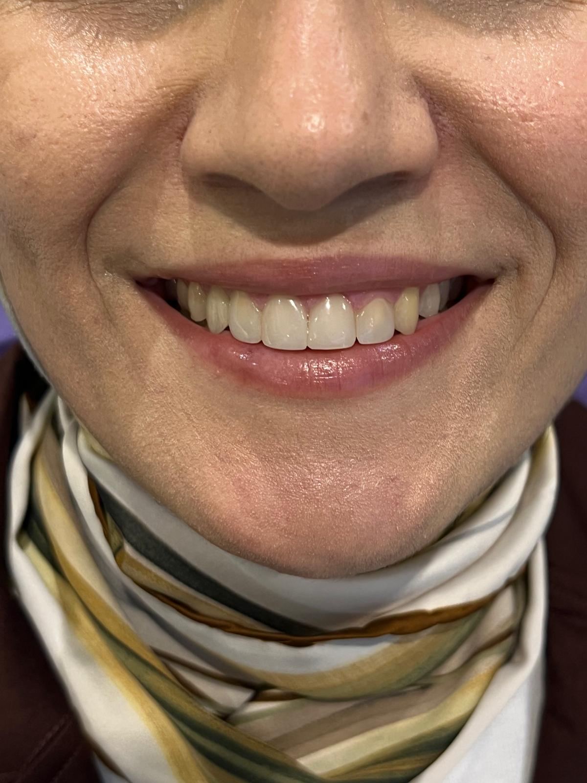 ECE Dental Patient Transformation